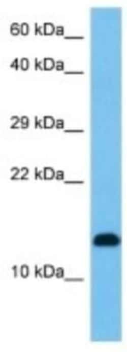 RPL30 Rabbit anti-Mouse, Polyclonal, Novus Biologicals 100 &mu;g | Buy Online | Novus Biologicals | Fisher Scientific